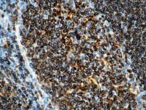 IHC of CD74 on an FFPE Tonsil Tissue